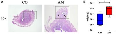 An insight into gut microbiota and metabolites in the mice with adenomyosis